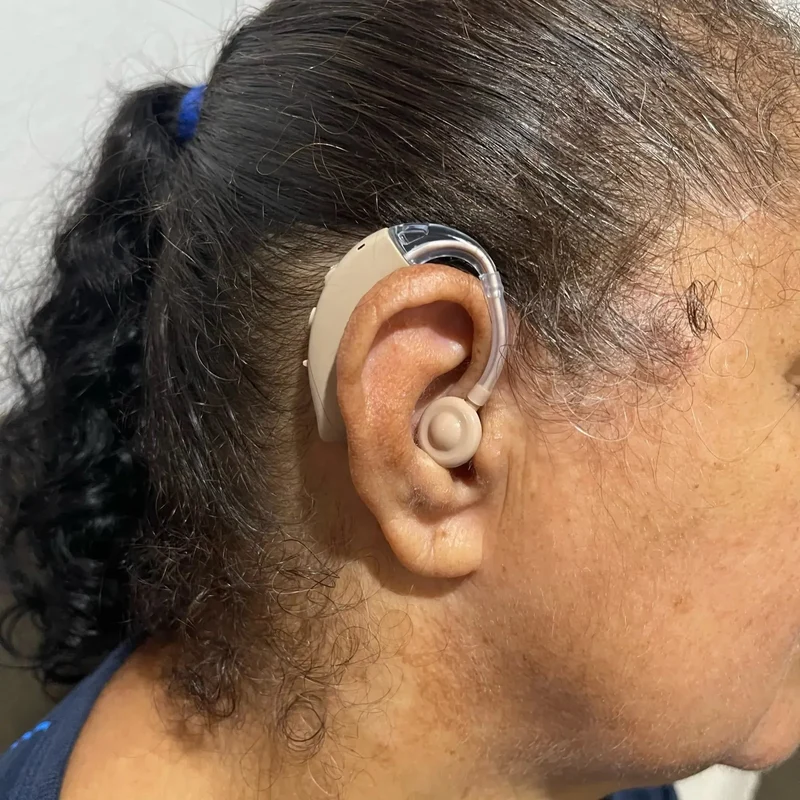 Geluidsversterker achter het oor – Oplaadbaar met ruisonderdrukking