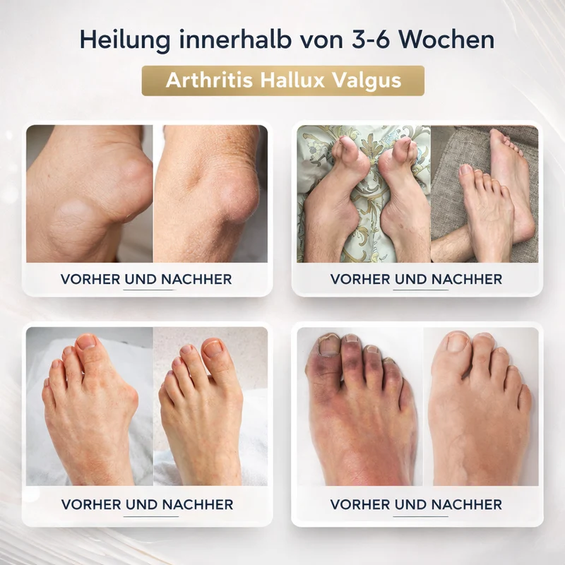 Bienengiftsalbe mit Hyaluron & Kollagen | BeeLixir